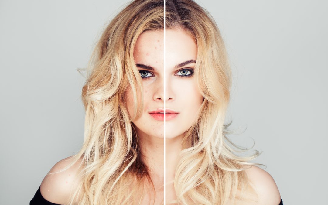 The Difference Between UnHealthy and Healthy Skin